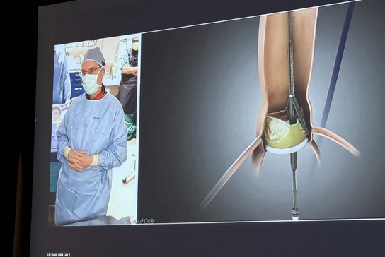 A presentation slide displays a live procedural image alongside a medical illustration during a conference session.